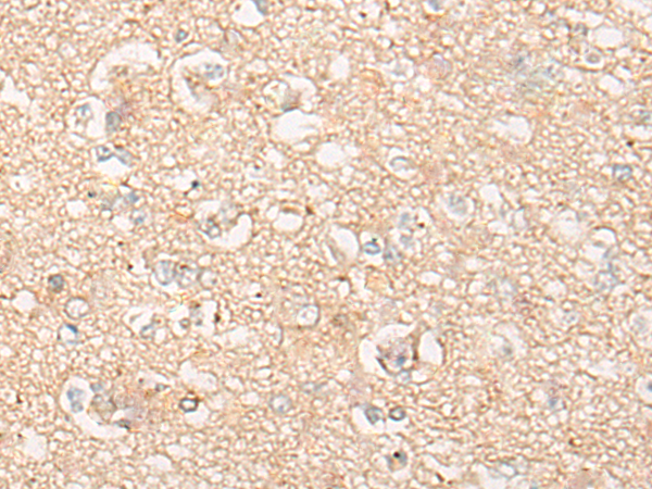 Rabbit Polyclonal Antibody to CYP26B1