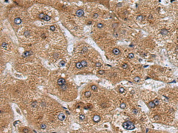 Rabbit Polyclonal Antibody to CYP2J2