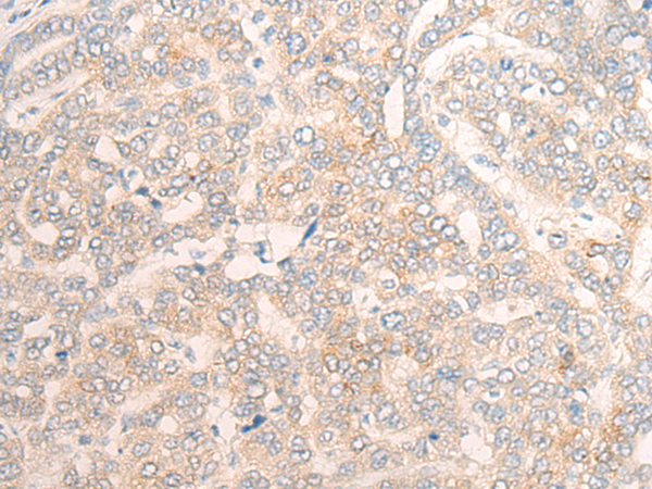 Rabbit Polyclonal Antibody to POR