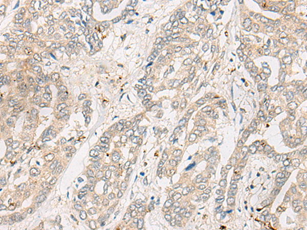 Rabbit Polyclonal Antibody to CYTH3