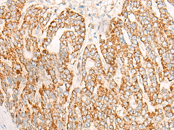 Rabbit Polyclonal Antibody to DAOA