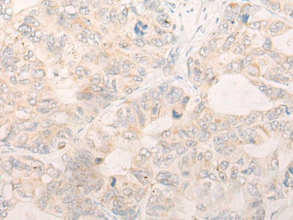 Rabbit Polyclonal Antibody to DALRD3