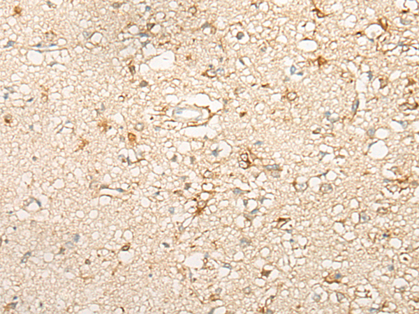 Rabbit Polyclonal Antibody to DACT2