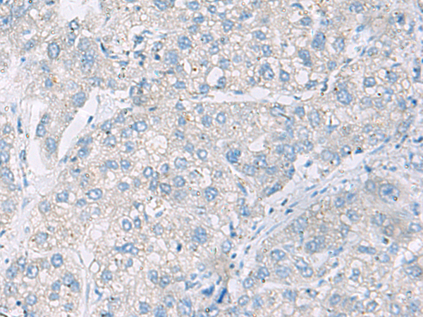 Rabbit Polyclonal Antibody to DACT3