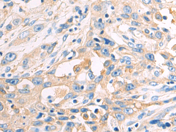 Rabbit Polyclonal Antibody to DARS1