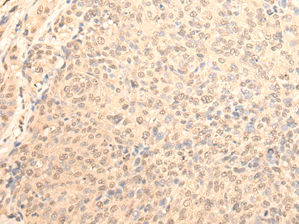 Rabbit Polyclonal Antibody to DAZ1