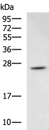 Rabbit Polyclonal Antibody to DCAKD