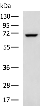 Rabbit Polyclonal Antibody to DCP1B