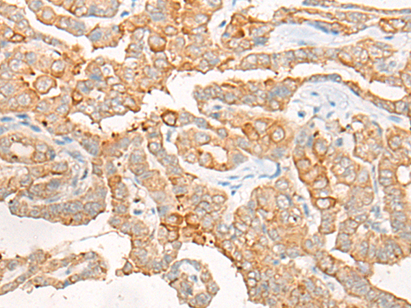 Rabbit Polyclonal Antibody to DCP2
