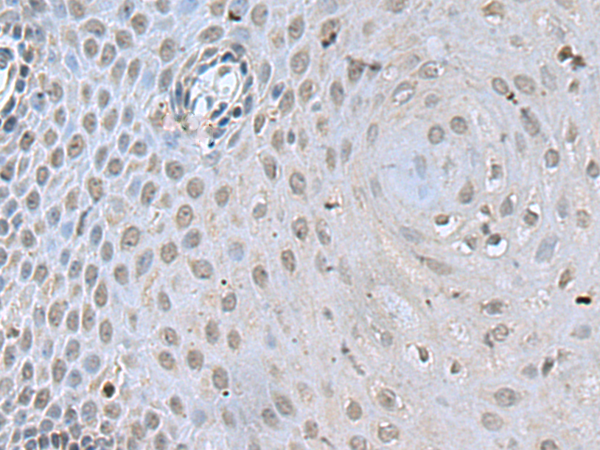 Rabbit Polyclonal Antibody to DCPS
