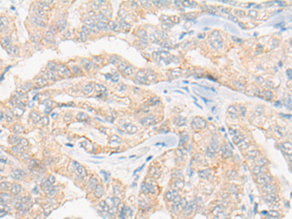 Rabbit Polyclonal Antibody to DDA1