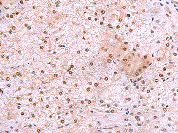 Rabbit Polyclonal Antibody to DDI2