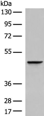 Rabbit Polyclonal Antibody to DDOST