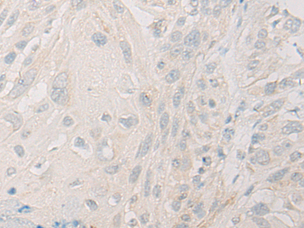 Rabbit Polyclonal Antibody to DDX19A