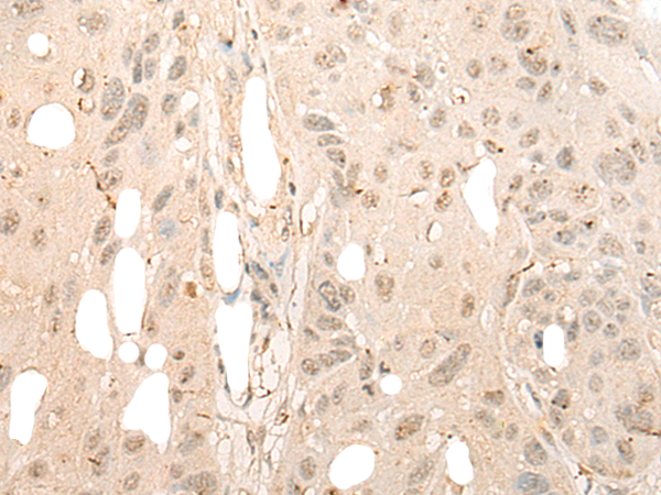 Rabbit Polyclonal Antibody to DDX21