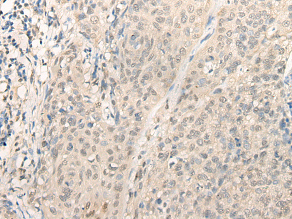 Rabbit Polyclonal Antibody to DDX23