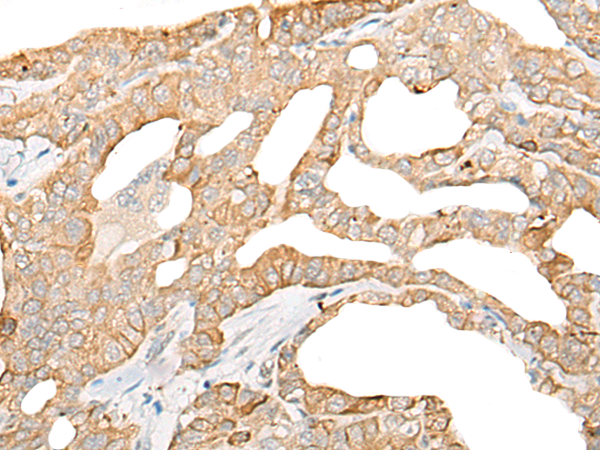 Rabbit Polyclonal Antibody to DDX24