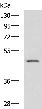 Rabbit Polyclonal Antibody to DDX39A