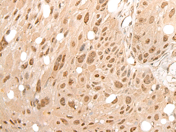 Rabbit Polyclonal Antibody to DDX3X