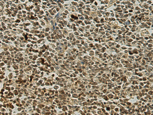Rabbit Polyclonal Antibody to DDX47