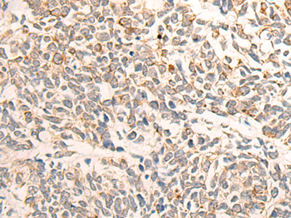 Rabbit Polyclonal Antibody to DDX54