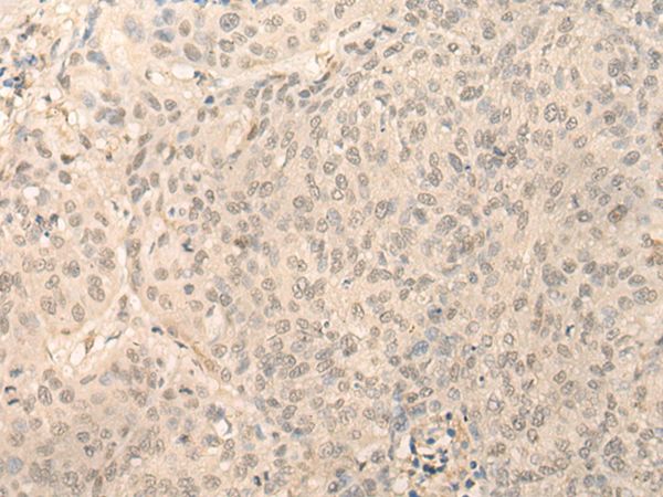 Rabbit Polyclonal Antibody to DDX59