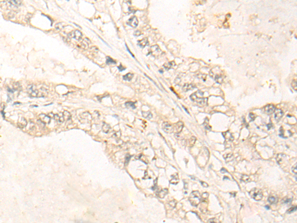 Rabbit Polyclonal Antibody to DDX52
