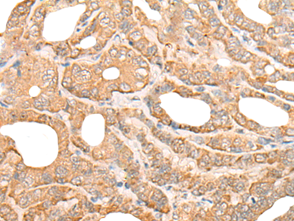 Rabbit Polyclonal Antibody to DEF8