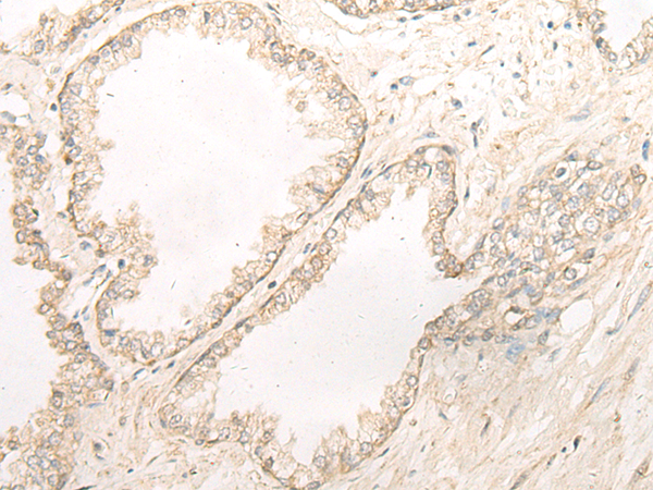 Rabbit Polyclonal Antibody to SGCA