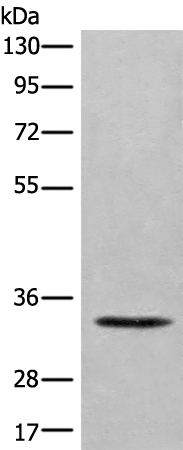 Rabbit Polyclonal Antibody to SGCD
