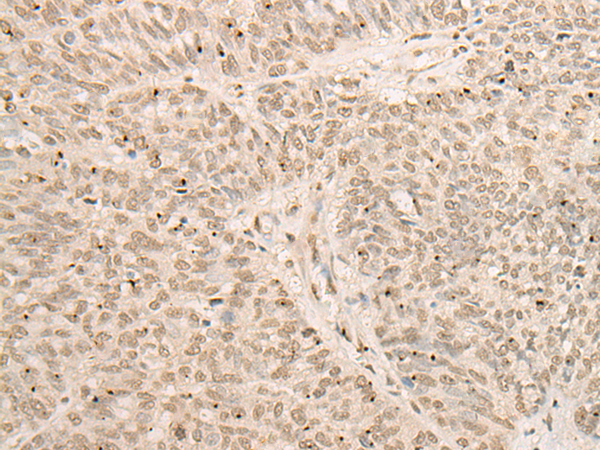 Rabbit Polyclonal Antibody to EXO5