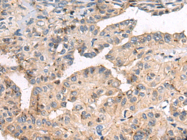 Rabbit Polyclonal Antibody to DENND1B