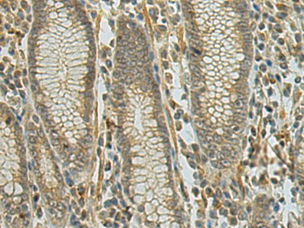 Rabbit Polyclonal Antibody to DENND1A
