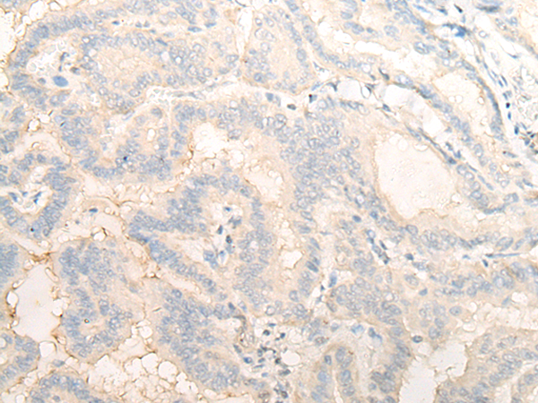 Rabbit Polyclonal Antibody to DENND1B