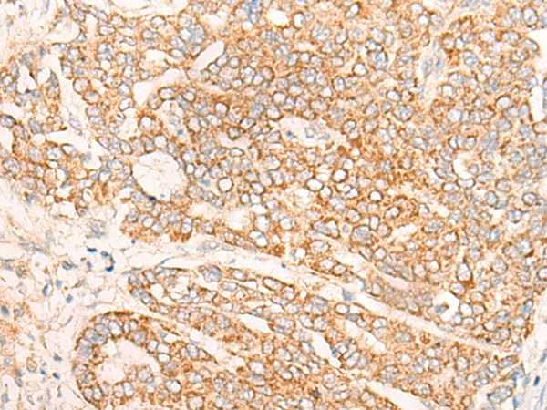 Rabbit Polyclonal Antibody to DENND5A