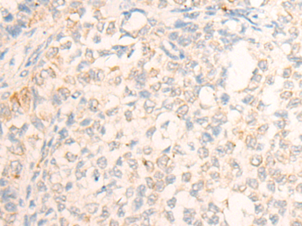 Rabbit Polyclonal Antibody to DPT