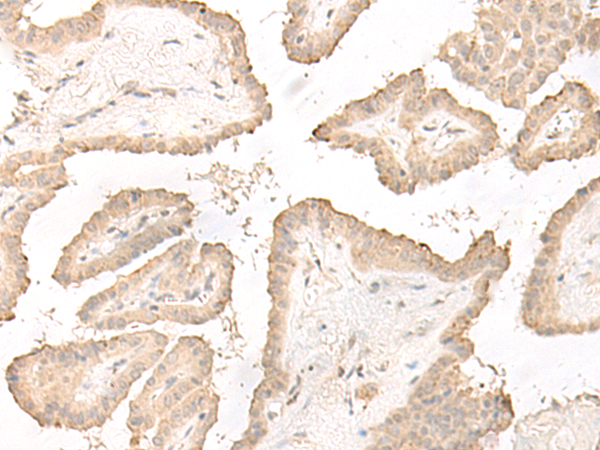 Rabbit Polyclonal Antibody to DCD