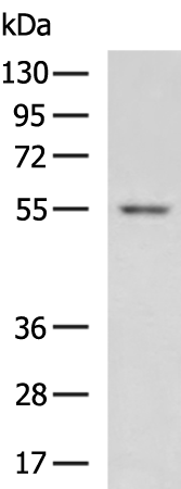 Rabbit Polyclonal Antibody to GSDME