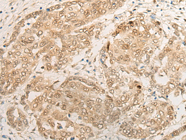 Rabbit Polyclonal Antibody to PSMB4