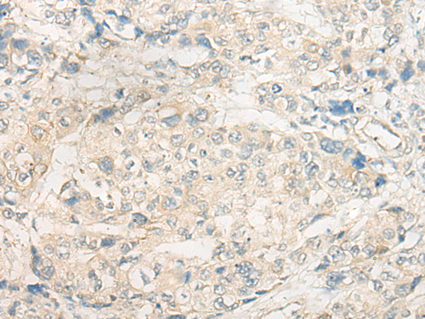 Rabbit Polyclonal Antibody to TSSK3