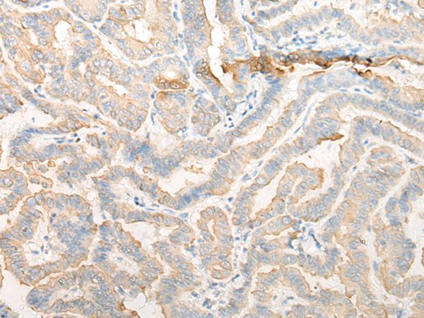 Rabbit Polyclonal Antibody to CELA3A