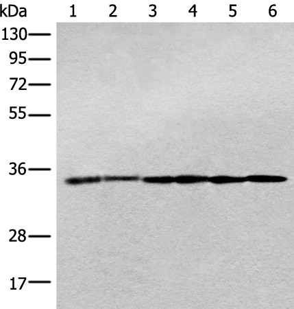 Rabbit Polyclonal Antibody to PITPNB
