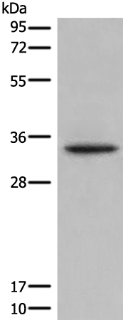 Rabbit Polyclonal Antibody to NUBP2