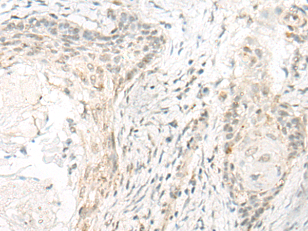 Rabbit Polyclonal Antibody to COMT