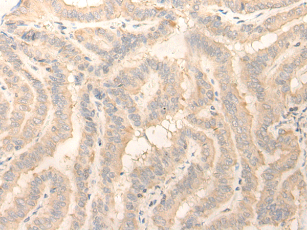 Rabbit Polyclonal Antibody to ERP27