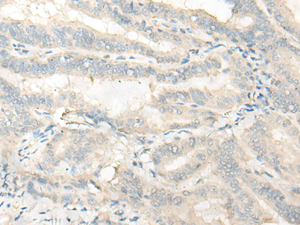 Rabbit Polyclonal Antibody to C11orf49
