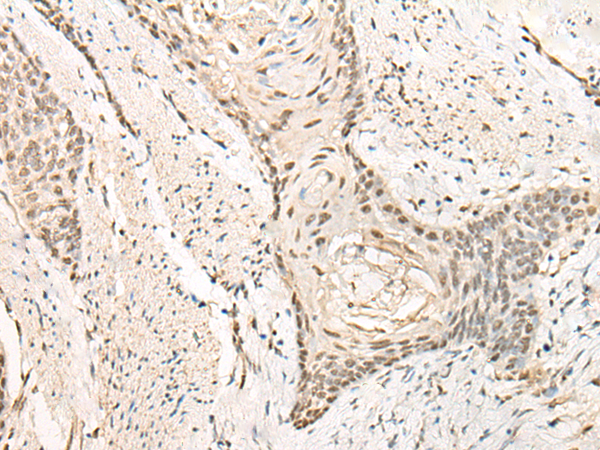 Rabbit Polyclonal Antibody to EXOSC3