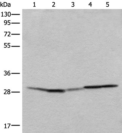 Rabbit Polyclonal Antibody to RSU1