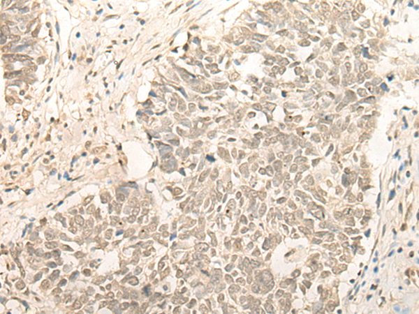 Rabbit Polyclonal Antibody to RBM11