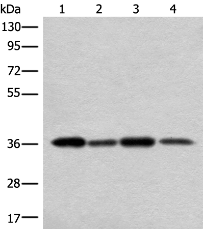 Rabbit Polyclonal Antibody to NIFK